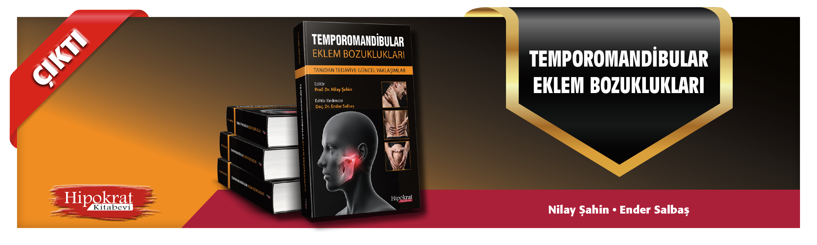 Temporomandibular Eklem Bozuklukları Tanıdan Tedaviye Güncel Yaklaşımlar